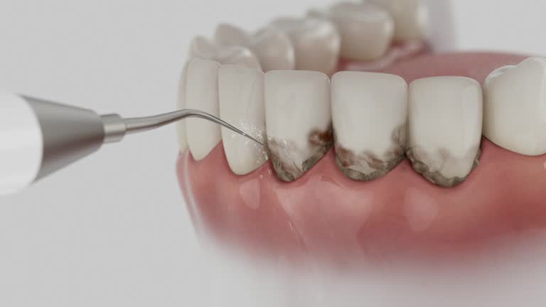 Reliable Dental contractor in Redan, GA by Smile Center Dentistry